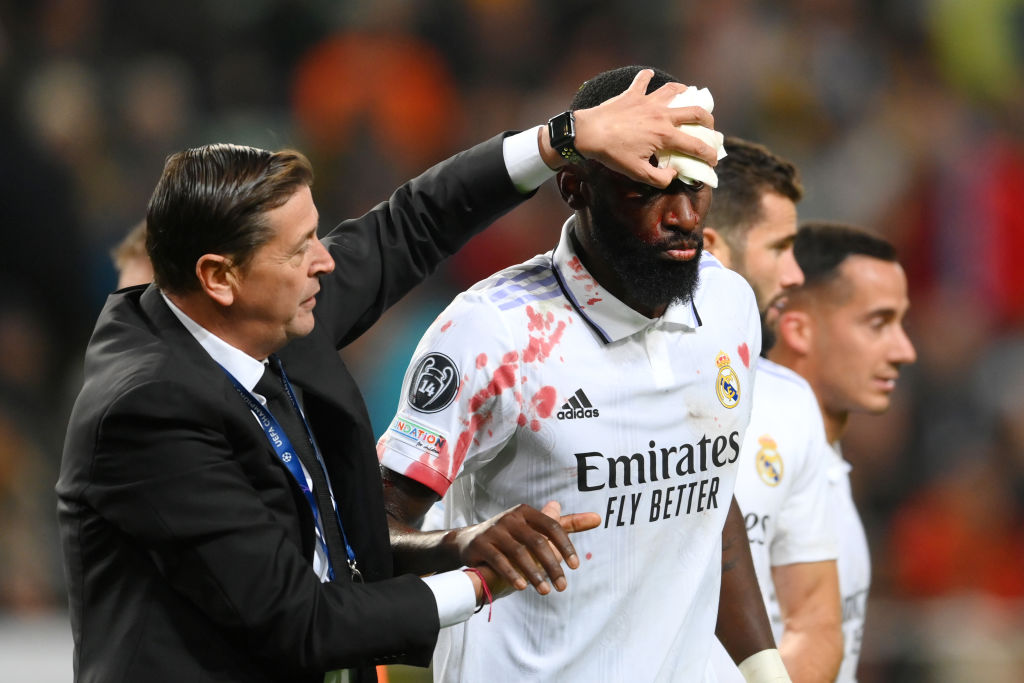 Horrorsérülést szenvedett a Real Madrid nyerőembere – videó