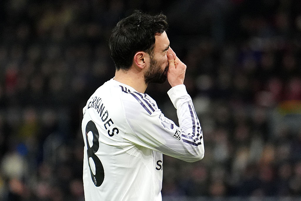 PL: a kiesőjelölt Burnley otthonában sem tudott nyerni a Manchester United – videóval